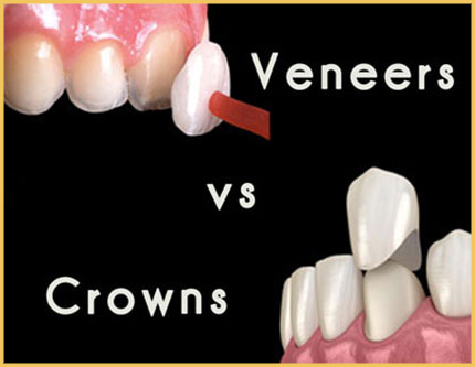 travel turkey for dental treatment