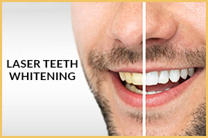 Laser Teeth Whitening