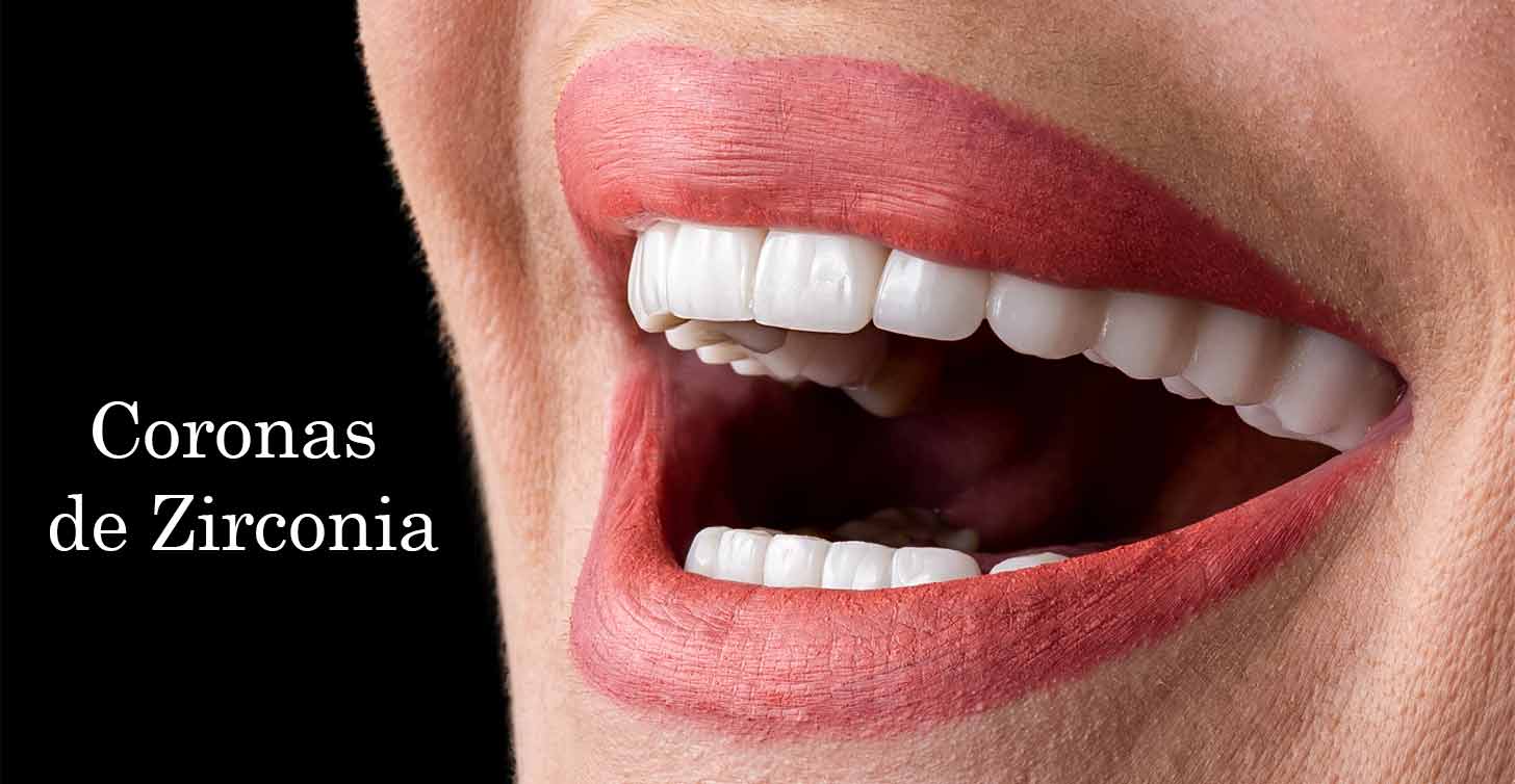 coronas de zirconia en turquia