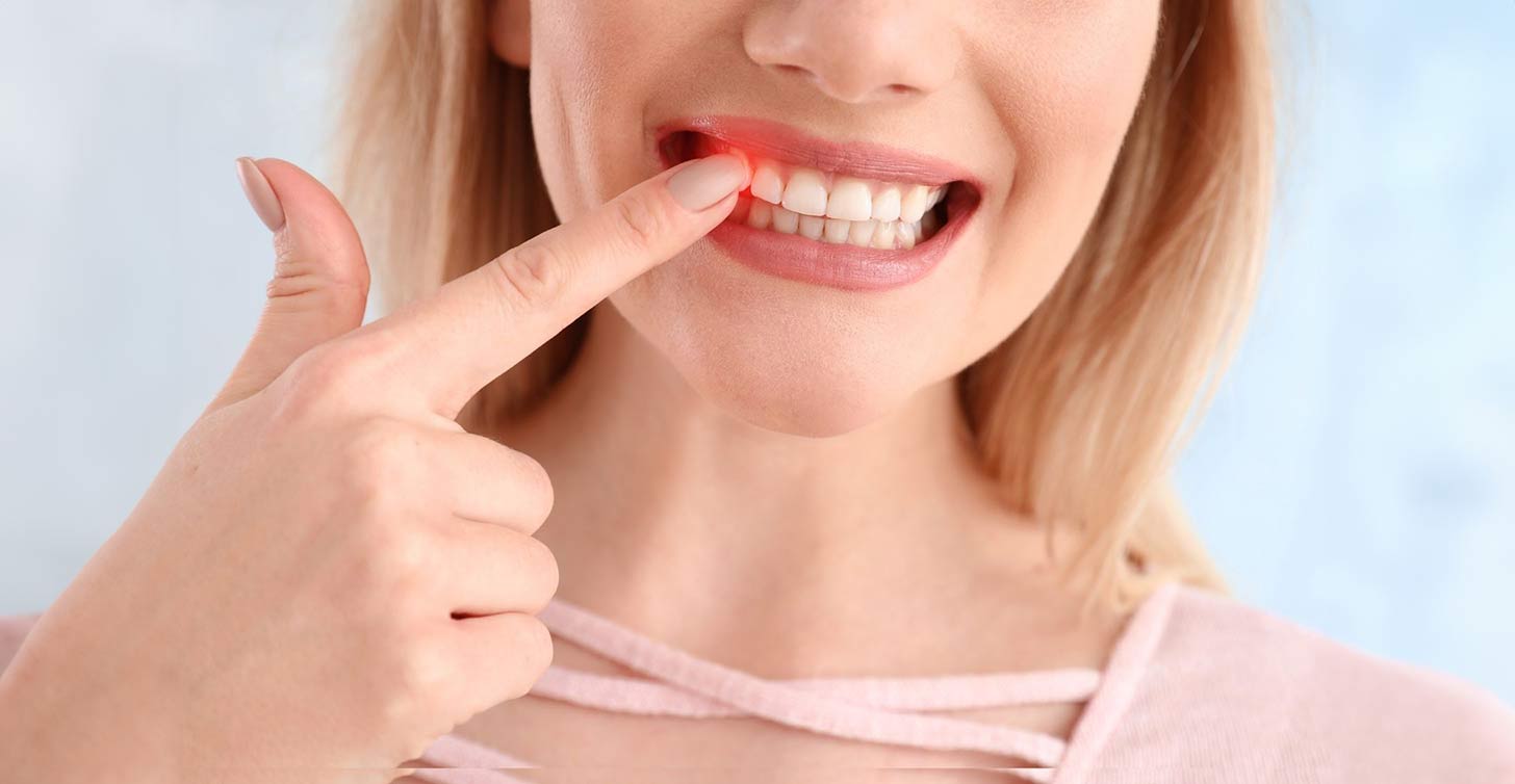 gum disease causes smptoms and prevention 1