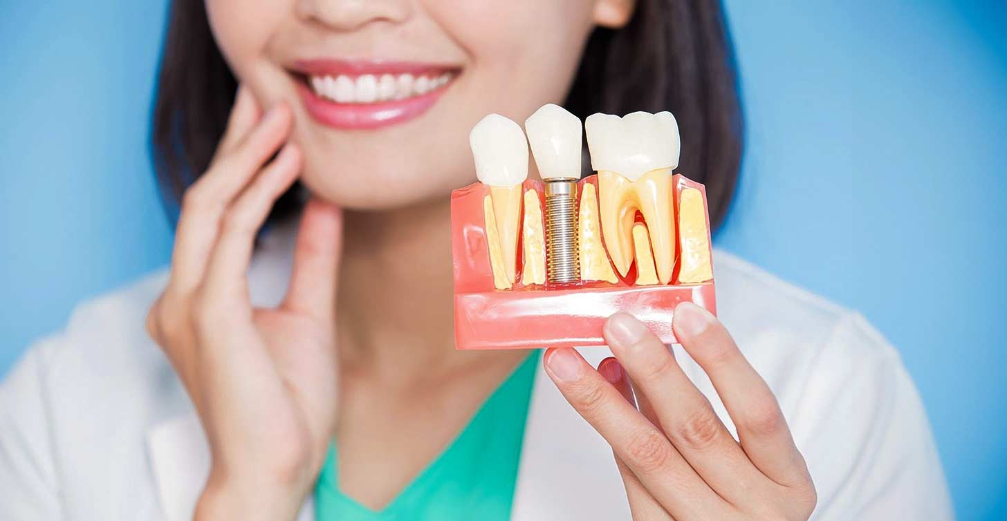 the permanent solution for missing teeth