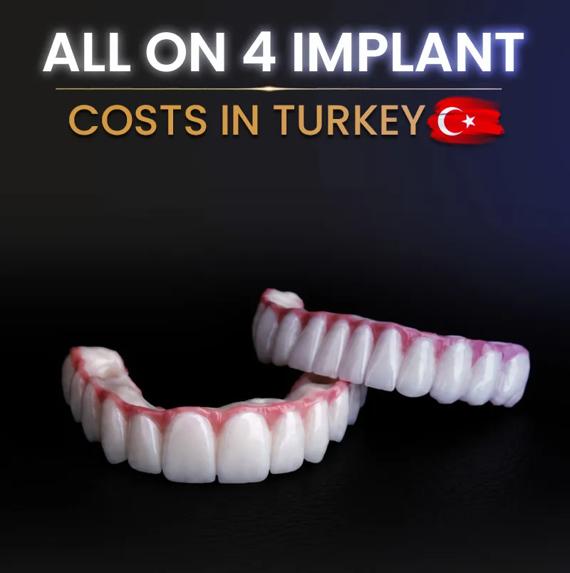 allon4-cost