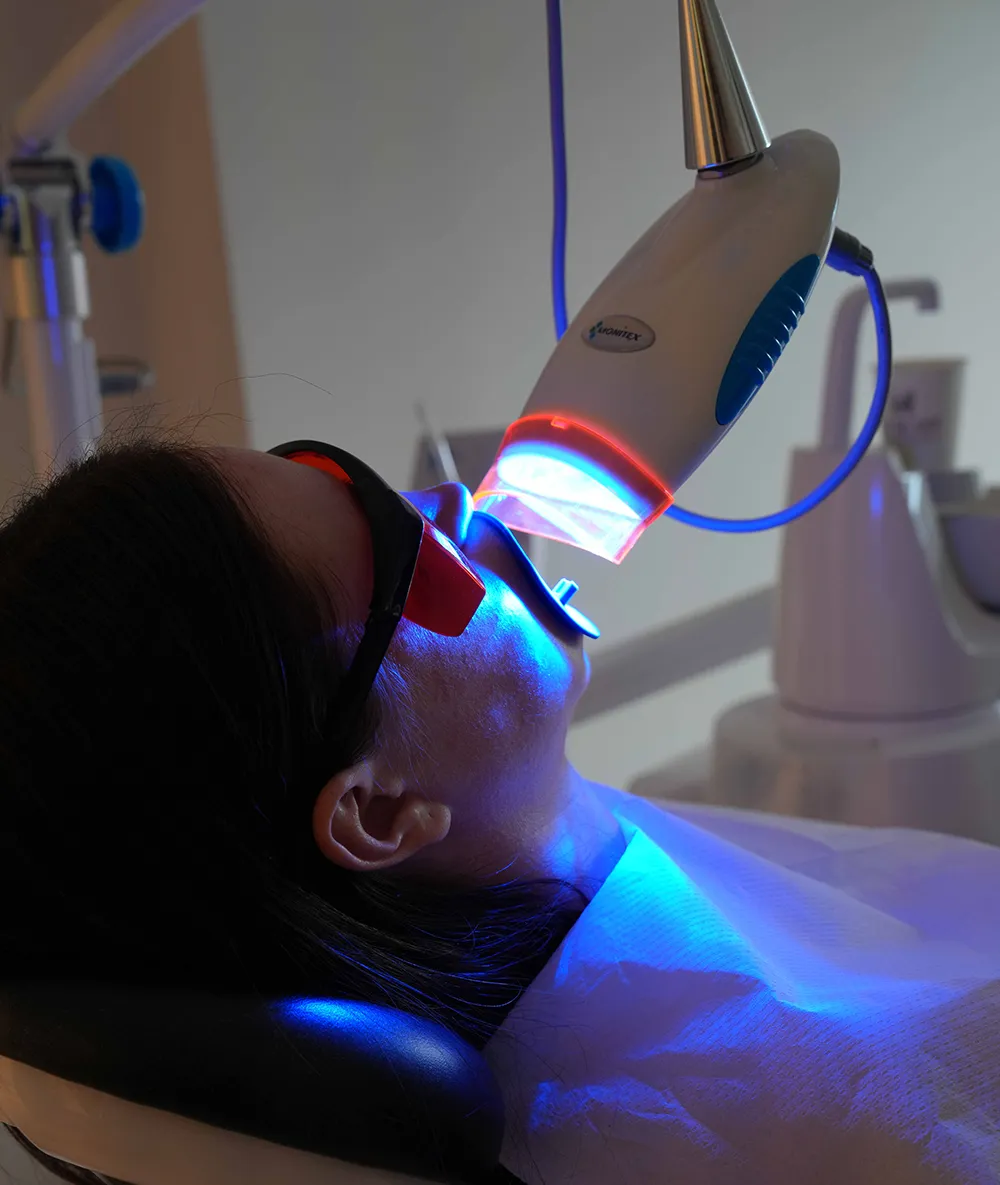 laser-whitening-kusadasi laser teeth kusadasi